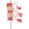 Model anatomiczny 3D osteoporozy lędźwiowej kręgi 3-5