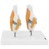 Model anatomiczny 3D stawu kolanowego ze zmianami chorobowymi 4 zmiany skala 1:2