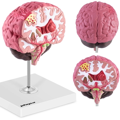 Model anatomiczny 3D mózgu ludzkiego z 3 patologiami skala 1:1