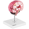 Model anatomiczny 3D mózgu ludzkiego z 3 patologiami skala 1:1