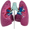 Model anatomiczny 3D płuca człowieka ze zmianami chorobowymi